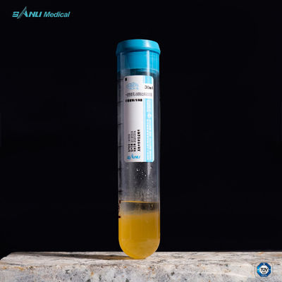 Сбросьте замучьте пробирку 20ml ACD-A PRP с ГЕЛЕМ для обработки OA